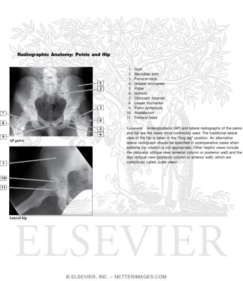 Watermarked preview of unlabeled image: Radiographic Anatomy of the Pelvis and Hip