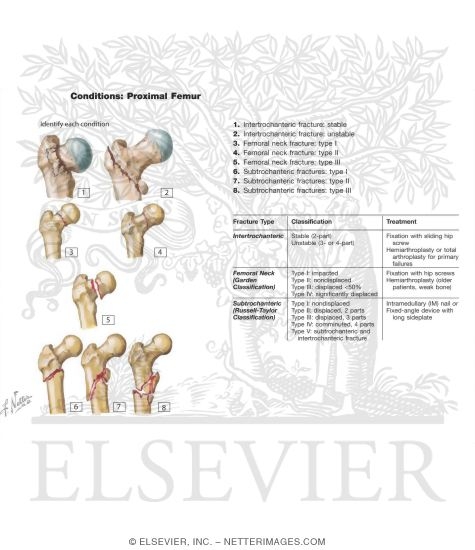 Watermarked preview of unlabeled image: Proximal Femur