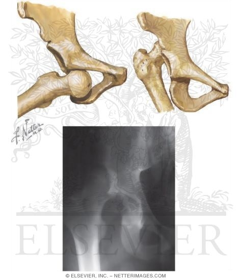 Hip Joint