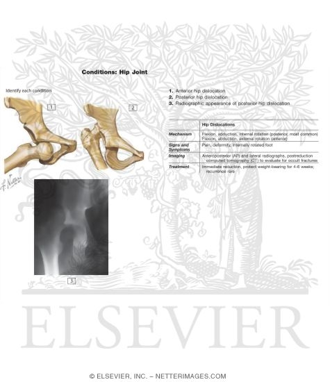 Hip Joint Biology Diagrams