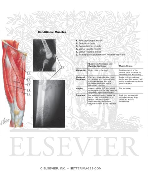 Watermarked preview of labeled image: Muscles of Front of Hip and Thigh