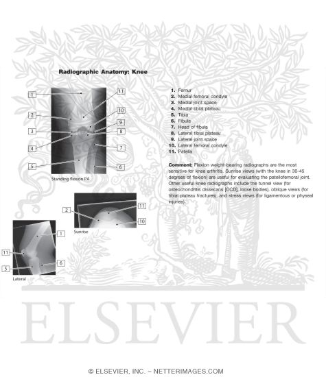 Watermarked preview of unlabeled image: Radiographic Anatomy of the Knee