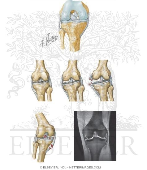 Watermarked preview of unlabeled image: Collateral Ligaments
