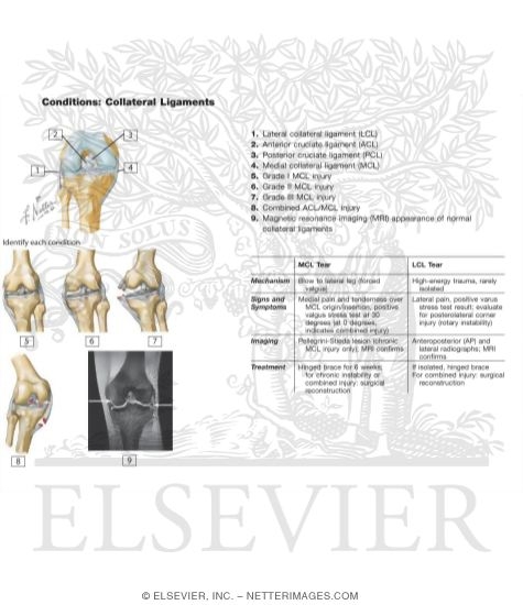 Watermarked preview of unlabeled image: Collateral Ligaments