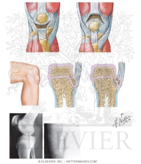 Watermarked preview of unlabeled image: Extensor Mechanism In the Knee