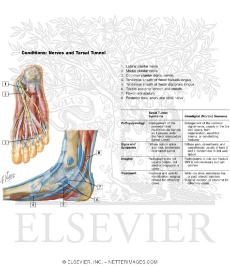 Watermarked preview of unlabeled image: Nerves and Tarsal Tunnel