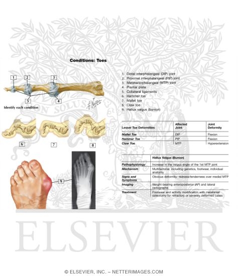 Toes