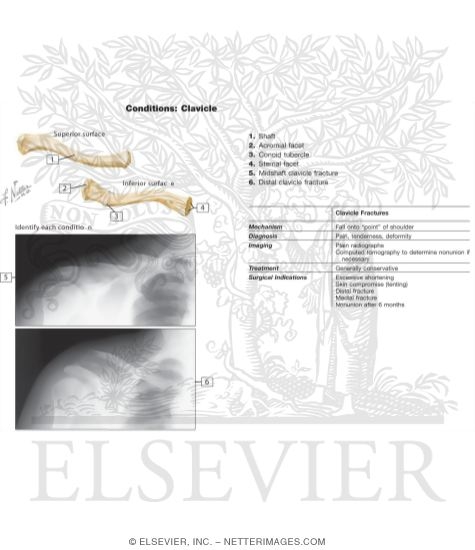 Shoulder: Bones (Pectoral Girdle)