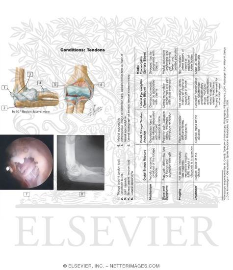 Watermarked preview of unlabeled image: Tendons In the Elbow