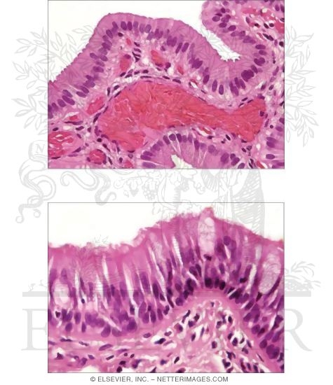 Simple Columnar and Pseudostratified Epithelia