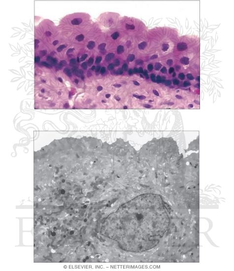 Transitional Epithelium
