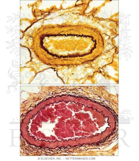 Elastic Connective Tissue