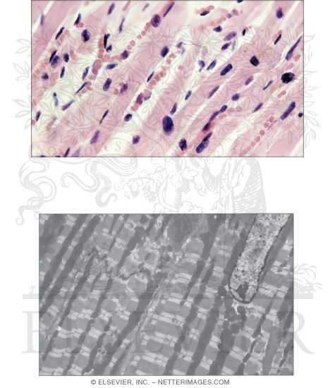 Watermarked preview of unlabeled image: Cardiac Muscle