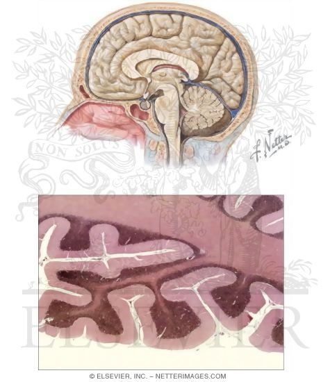 Watermarked preview of unlabeled image: Cerebellum