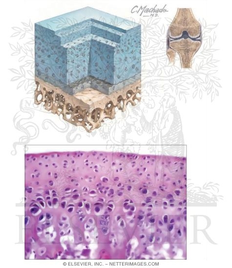 Watermarked preview of unlabeled image: Articular Hyaline Cartilage