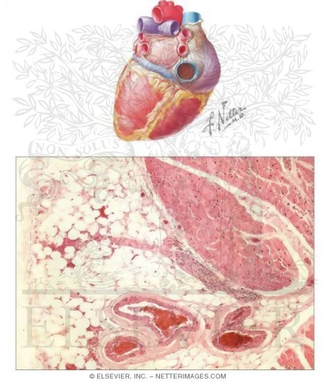 Watermarked preview of unlabeled image: Heart Wall and Pericardium