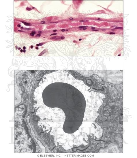 Tight Capillary
