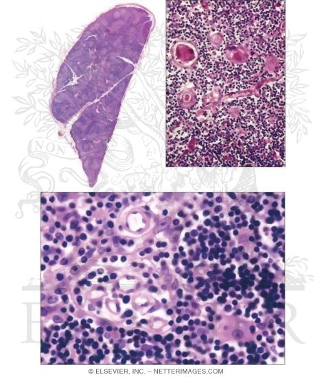 Thymus