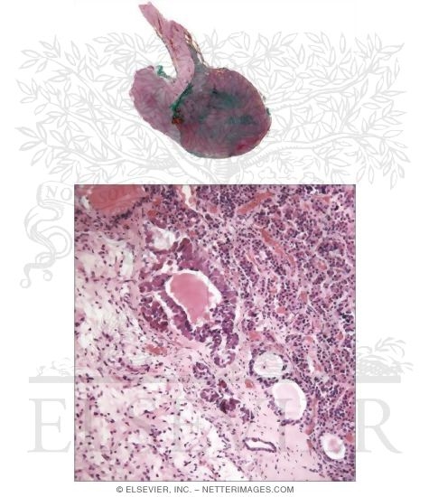 Intermediate Lobe