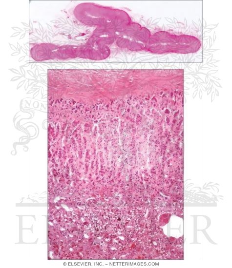 Watermarked preview of unlabeled image: Adrenal