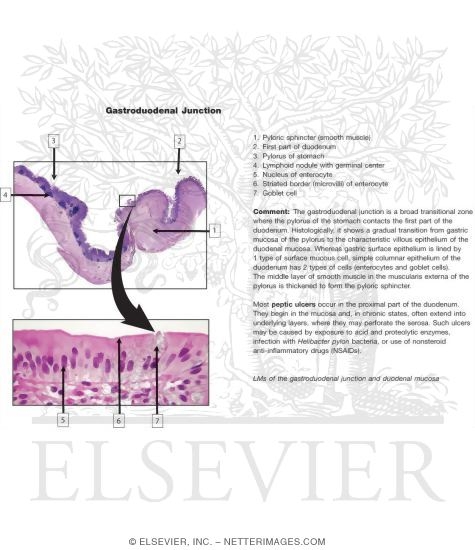 Gastroduodenal Junction