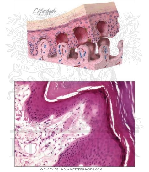 Watermarked preview of unlabeled image: Thick Skin