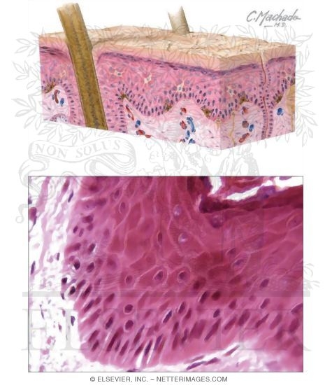 Watermarked preview of unlabeled image: Epidermis