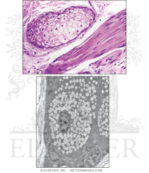 Watermarked preview of unlabeled image: Sebaceous Gland