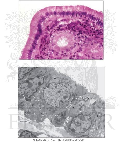 Gallbladder Epithelium