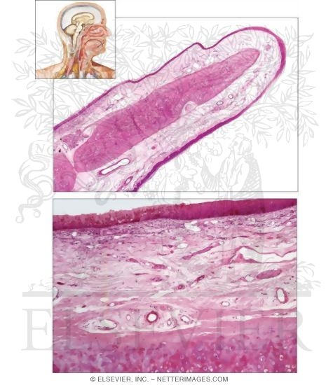 Epiglottis