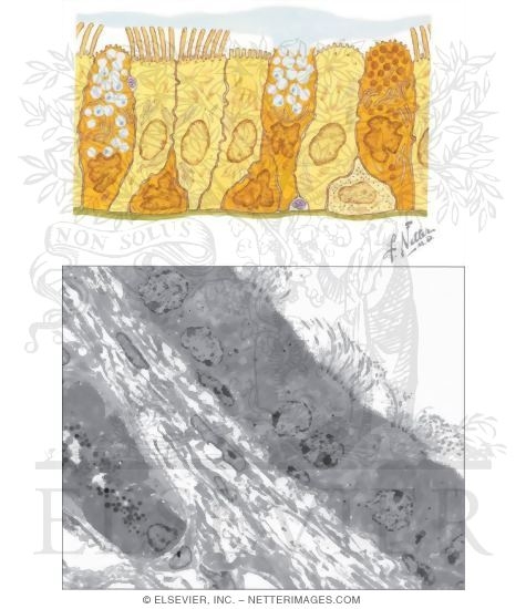 Watermarked preview of unlabeled image: Tracheal Epithelium