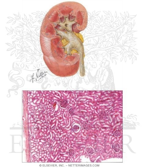 Watermarked preview of unlabeled image: Kidney