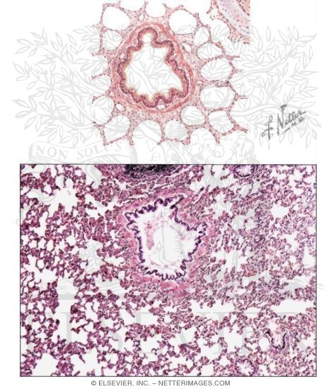 Watermarked preview of unlabeled image: Bronchiole