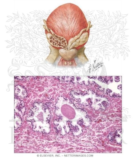 Watermarked preview of unlabeled image: Prostate