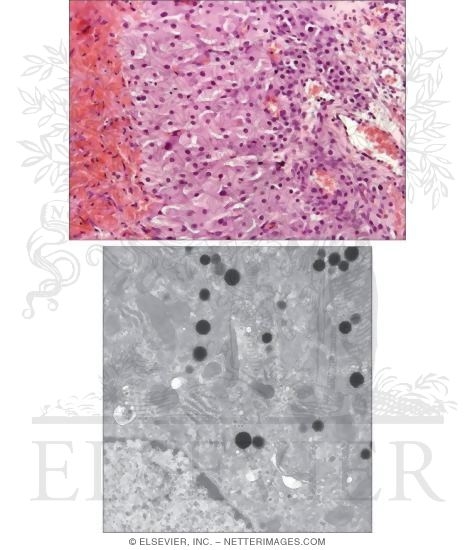 Corpus Luteum