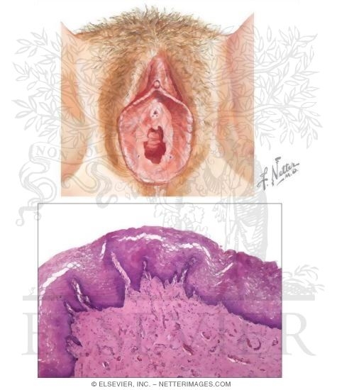 External Genitalia and Vagina