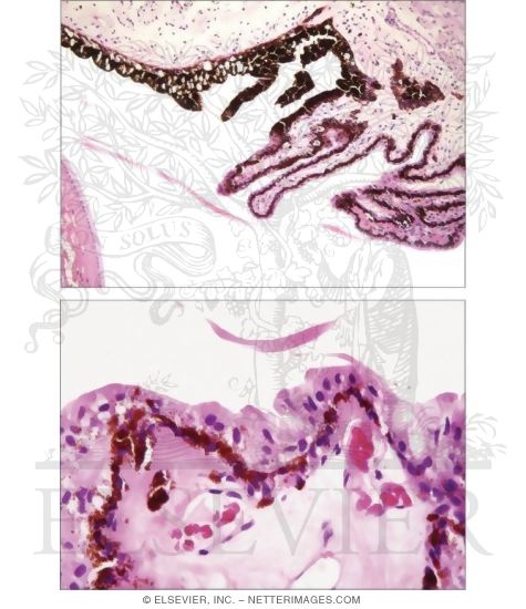 Ciliary Body