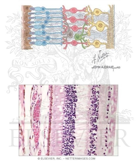 Watermarked preview of unlabeled image: Retina