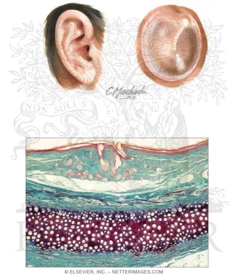 acoustic meatus