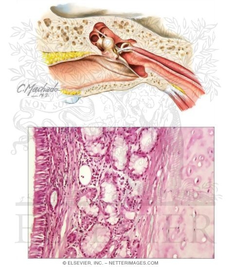 Middle Ear and Auditory Tube
