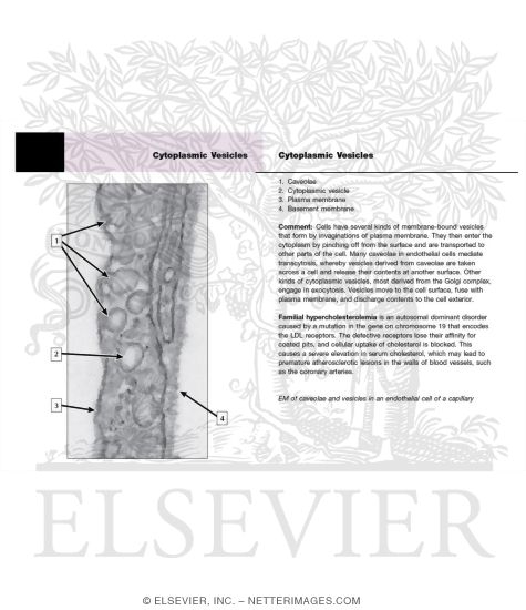 Watermarked preview of labeled image: Electron Micrograph of Caveolae and Vesicles at High Magnification