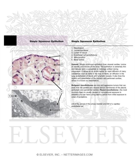 Watermarked preview of unlabeled image: Simple Squamous Epithelium