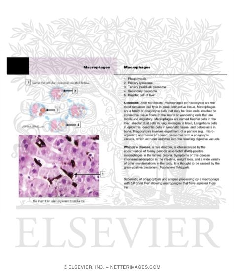 Watermarked preview of unlabeled image: Macrophages