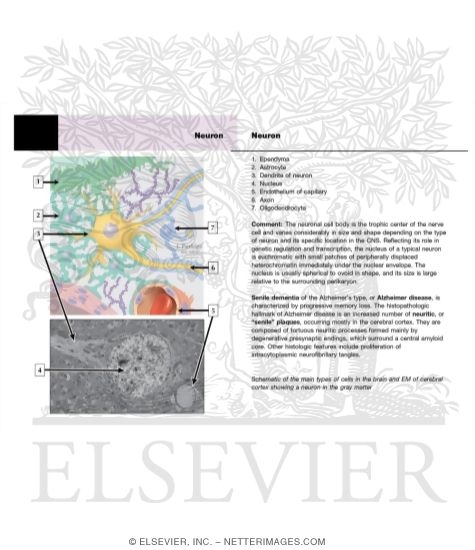Watermarked preview of unlabeled image: Neuron