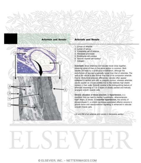 Watermarked preview of labeled image: An Arteriole and a Venule In Transverse Section With an Electron Micrograph of Walls of an Arteriole and a Venule