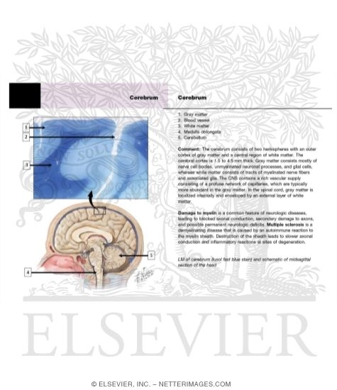 Watermarked preview of unlabeled image: Cerebrum