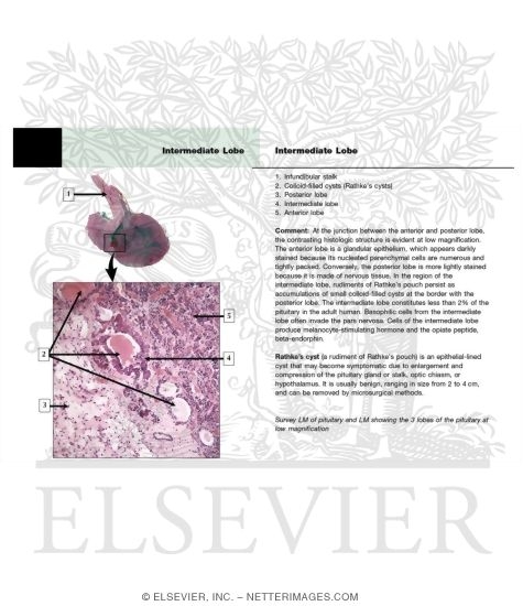Watermarked preview of unlabeled image: Intermediate Lobe
