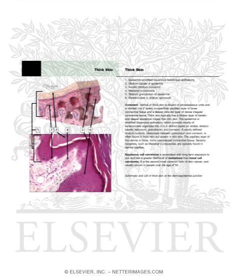 Watermarked preview of unlabeled image: Thick Skin