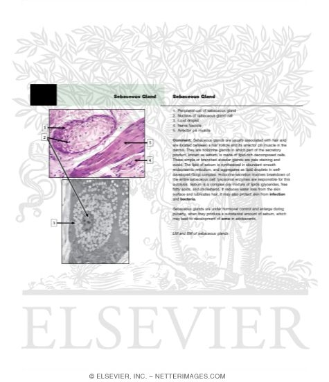Watermarked preview of unlabeled image: Sebaceous Gland