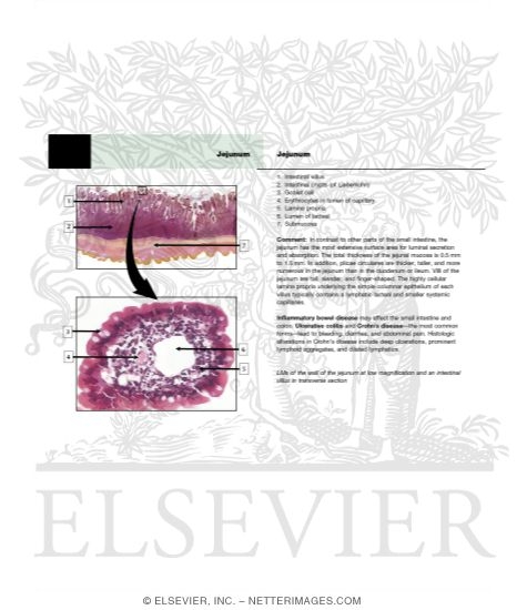 Watermarked preview of unlabeled image: Jejunum